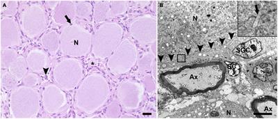 Morphological and phenotypical characteristics of porcine satellite glial cells of the dorsal root ganglia